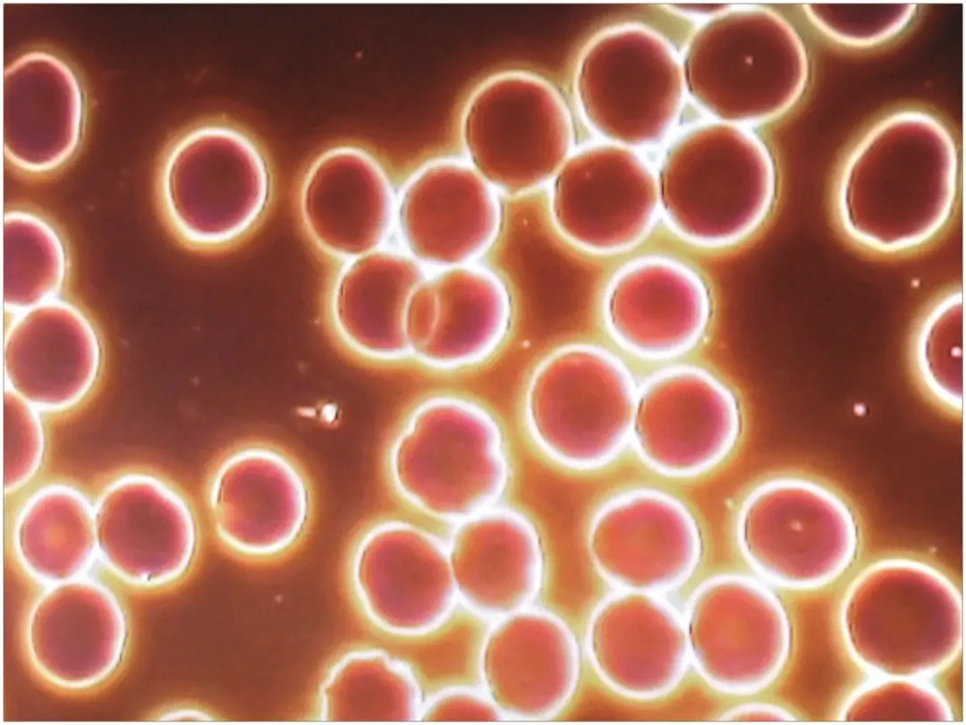 Sangre humana con Bio Music One