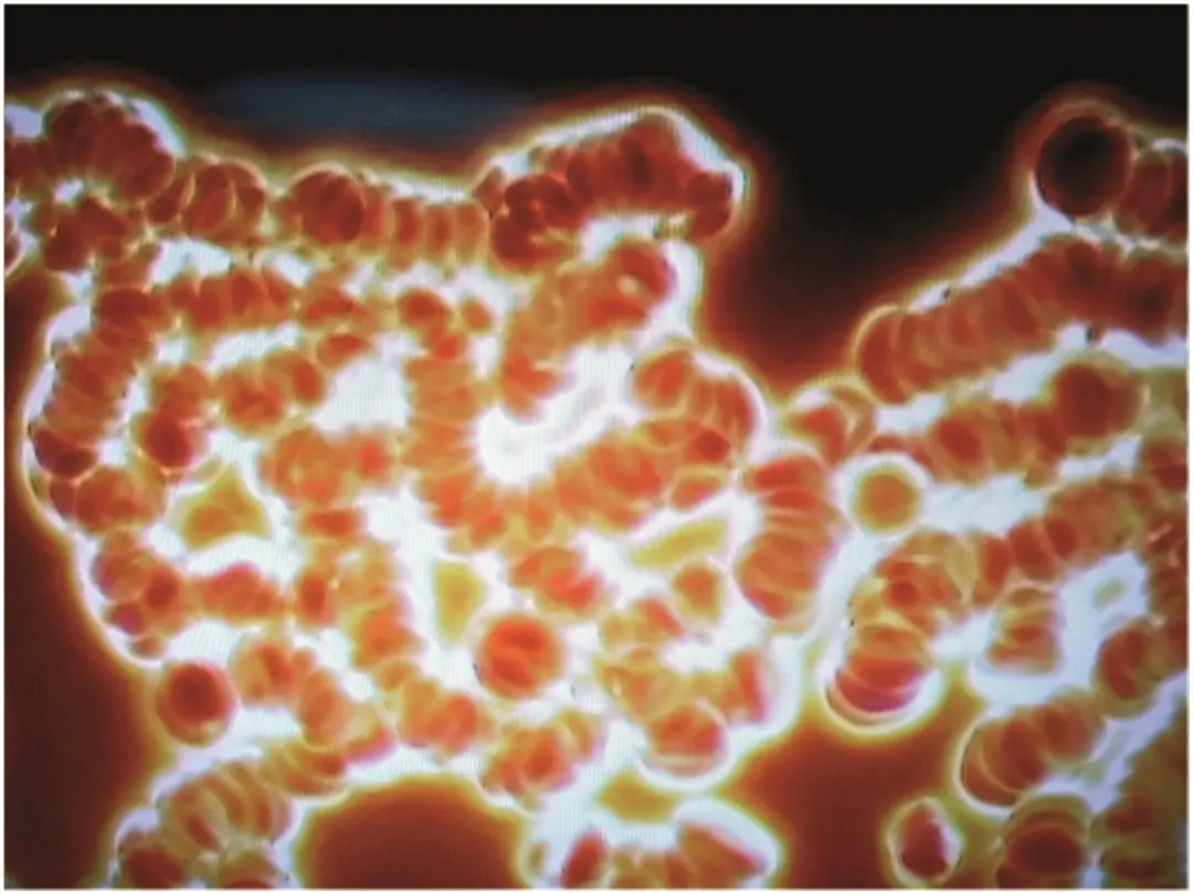 Sangre humana sin Bio Music One